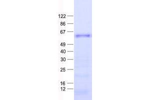 Validation with Western Blot (ZNF582 Protein (His tag))