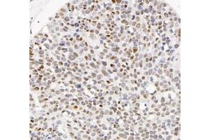 Immunohistochemistry (Paraffin-embedded Sections) (IHC (p)) image for anti-Adrenergic, alpha-1B-, Receptor (ADRA1B) antibody (ABIN7072974)