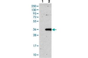 Western blot analysis of Lane 1: Negative control (vector only transfected HEK293T lysate), Lane 2: Over-expression Lysate (Co-expressed with a C-terminal myc-DDK tag (~3. (ROGDI antibody)
