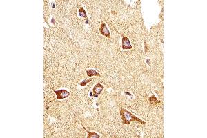 Immunohistochemical analysis of paraffin-embedded H. (PTGER4 antibody  (AA 242-269))