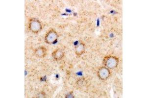 Immunohistochemistry (IHC) image for anti-Transforming Growth Factor, beta Receptor II (70/80kDa) (TGFBR2) antibody (ABIN7302934)