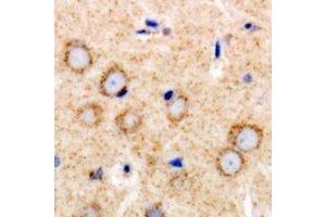 Immunohistochemical analysis of TGFBR2 staining in human brain formalin fixed paraffin embedded tissue section. (TGFBR2 antibody)
