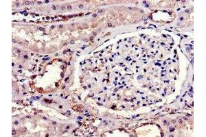 Immunohistochemistry of paraffin-embedded human kidney tissue using ABIN7156864 at dilution of 1:100 (IL23R antibody  (AA 15-125))