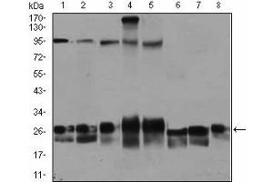 Western Blotting (WB) image for anti-RAB4A, Member RAS Oncogene Family (RAB4A) antibody (ABIN1108812) (Rab4 antibody)