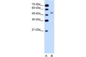 WB Suggested Anti-SLC12A1 Antibody Titration:  0.