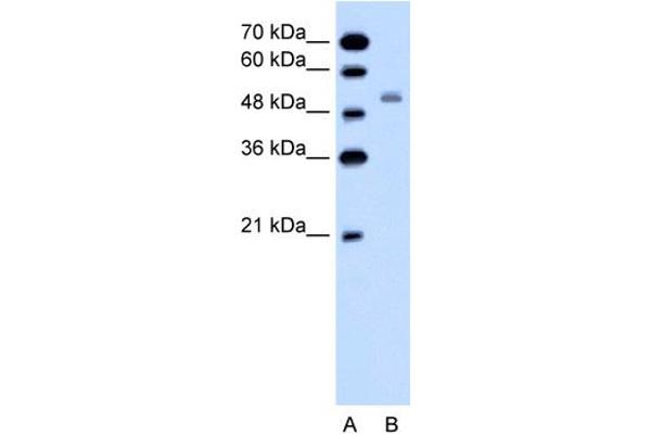 SLC12A1 Antikörper  (N-Term)