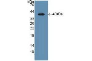 Detection of Recombinant UNG, Human using Polyclonal Antibody to Uracil DNA Glycosylase (UNG) (UNG antibody  (AA 1-313))
