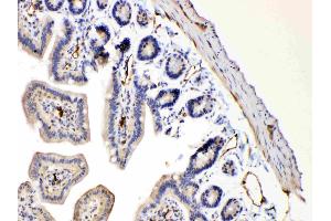 IHC analysis of Bax using anti-Bax antibody . (BAX antibody  (N-Term))