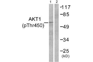 Western Blotting (WB) image for anti-V-Akt Murine Thymoma Viral Oncogene Homolog 1 (AKT1) (pThr450) antibody (ABIN1847254) (AKT1 antibody  (pThr450))