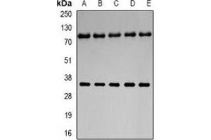 Western blot analysis of Neuroglobin expression in U251 (A), mouse liver (B), mouse brain (C), rat liver (D), rat brain (E) whole cell lysates. (Neuroglobin antibody)