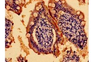 Immunohistochemistry of paraffin-embedded human small intestine tissue using ABIN7159092 at dilution of 1:100 (TMEM67 antibody  (AA 241-500))