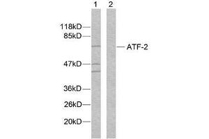 Western blot analysis of extracts from MDA-MB-435 cells using ATF-2 (Ab-112 or 94) antibody (E021033). (ATF2 antibody)