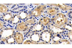 Detection of CASP1 in Human Kidney Tissue using Polyclonal Antibody to Caspase 1 (CASP1) (Caspase 1 antibody  (AA 317-404))