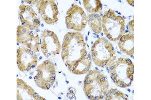 M6PR antibody