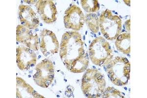 Immunohistochemistry of paraffin-embedded Human stomach using M6PR Polyclonal Antibody at dilution of 1:100 (40x lens).