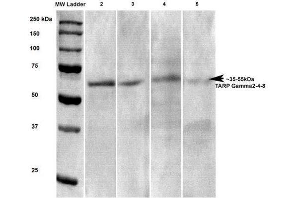 Stargazin Antikörper  (AA 203-323) (HRP)