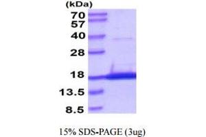SDS-PAGE (SDS) image for SNAP-Associated Protein (SNAPIN) (AA 1-136) protein (His tag) (ABIN666875)