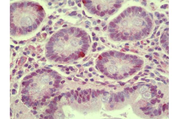 PRICKLE4 antibody  (N-Term)