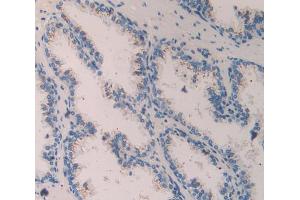 IHC-P analysis of Human Prostate Gland Tissue, with DAB staining. (Contactin 4 antibody  (AA 731-980))