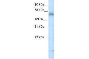 WB Suggested Anti-TBX6 Antibody   Titration: 5 ug/ml   Positive Control: Placenta (T-Box 6 antibody  (N-Term))