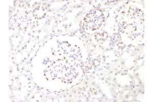 IHC testing of FFPE rat kidney with WT1 antibody. (WT1 antibody)