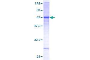 Image no. 1 for Asparagine-Linked Glycosylation 5, Dolichyl-Phosphate beta-Glucosyltransferase Homolog (S. Cerevisiae) (ALG5) (AA 1-324) protein (GST tag) (ABIN1344879)