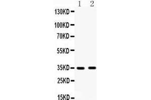 Anti- HSD17B6 antibody, Western blotting All lanes: Anti HSD17B6  at 0. (HSD17B6 antibody  (C-Term))
