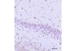 IHC analysis of TARS2 using anti-TARS2 antibody (ABIN7602308).