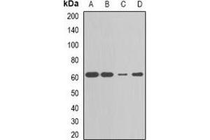 Western blot analysis of CBX4 expression in MCF7 (A), HepG2 (B), Jurkat (C), mouse liver (D) whole cell lysates.