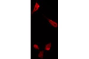 ABIN6266485 staining K562 by IF/ICC. (ENOS antibody  (C-Term))