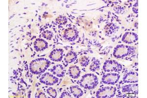 Formalin-fixed and paraffin embedded mouse intestine labeled with Rabbit Anti Phospho-Talin (Ser425) Polyclonal Antibody, Unconjugated (ABIN703135) at 1:200 followed by conjugation to the secondary antibody and DAB staining (Talin antibody  (pSer425))