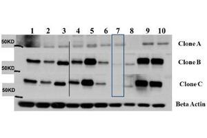 Western Blot of Mouse Anti-AKT3 antibody. (AKT3 antibody  (Internal Region) (Biotin))