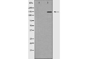 Western blot analysis of ACE1 expression in mouse kidney,The lane on the left is treated with the antigen-specific peptide. (Angiotensin I Converting Enzyme 1 antibody  (Internal Region))