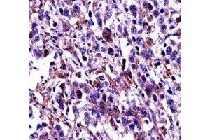 Oct-2 antibody immunohistochemistry analysis in formalin fixed and paraffin embedded human testis carcinoma. (Oct-2 antibody  (AA 10-39))