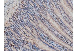 ABIN6267554 at 1/100 staining rat intestinal tissue sections by IHC-P.