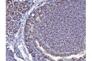 IHC analysis of MCM6 using anti-MCM6 antibody (ABIN7600035).