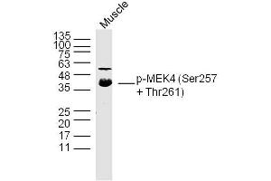 Mouse Muscle lysates probed with p-MEK4(Ser257 + Thr261) Polyclonal Antibody, Unconjugated  at 1:300 dilution and 4˚C overnight incubation. (MAP2K4 antibody  (pSer257, pThr261))
