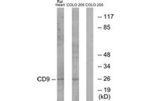 Western blot analysis of extracts from rat heart/COLO cells, using CD9 Antibody. (CD9 antibody  (AA 101-150))