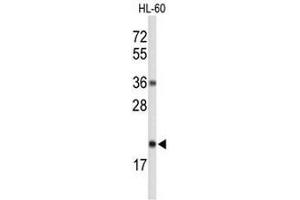 Western blot analysis of RNH2C Antibody (Center) in HL-60 cell line lysates (35µg/lane). (RNASEH2C antibody  (Middle Region))