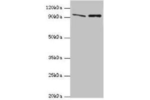 Western blot All lanes: NVL antibody at 10 μg/mL Lane 1: Mouse thymus tissue Lane 2: Hela whole cell lysate Secondary Goat polyclonal to rabbit IgG at 1/10000 dilution Predicted band size: 96, 83, 73, 74, 86 kDa Observed band size: 96 kDa (NVL antibody  (AA 340-520))