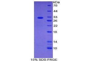 SDS-PAGE (SDS) image for Cell Death-Inducing DFFA-Like Effector C (CIDEC) (AA 1-251) protein (His tag) (ABIN2124283)