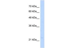 Western Blotting (WB) image for anti-Nudix (Nucleoside Diphosphate Linked Moiety X)-Type Motif 16-Like 1 (NUDT16L1) antibody (ABIN2463181) (NUDT16L1 antibody)