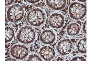 Image no. 1 for anti-Melanoma Antigen Family A, 4 (MAGEA4) antibody (ABIN1499260) (MAGEA4 antibody)