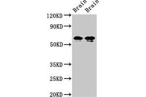 Western Blot Positive WB detected in: Rat brain tissue, Mouse brain tissue All lanes: STXBP1 antibody at 2 μg/mL Secondary Goat polyclonal to rabbit IgG at 1/50000 dilution Predicted band size: 68, 69 kDa Observed band size: 68, 69 kDa (STXBP1 antibody  (AA 245-594))