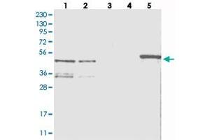 Western blot analysis of Lane 1: RT-4, Lane 2: U-251 MG, Lane 3: Human Plasma, Lane 4: Liver, Lane 5: Tonsil with ZNF641 polyclonal antibody  at 1:250-1:500 dilution. (ZNF641 antibody)