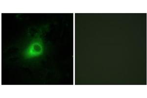 Immunofluorescence analysis of HeLa cells, using GRK6 antibody. (GRK6 antibody  (N-Term))