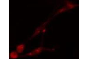 ABIN6275510 staining HT29 cells by IF/ICC. (PHAX antibody  (Internal Region))