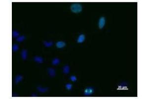 Immunostaining analysis in HeLa cells. (TPX2 antibody)