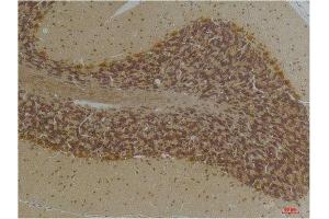 Immunohistochemistry (IHC) analysis of paraffin-embedded Human Brain Tissue using KCNN2(SK2) Rabbit Polyclonal Antibody diluted at 1:200. (KCNN2 antibody)