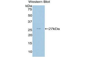 Western Blotting (WB) image for anti-GATA Binding Protein 4 (GATA4) (AA 228-440) antibody (ABIN3208751)